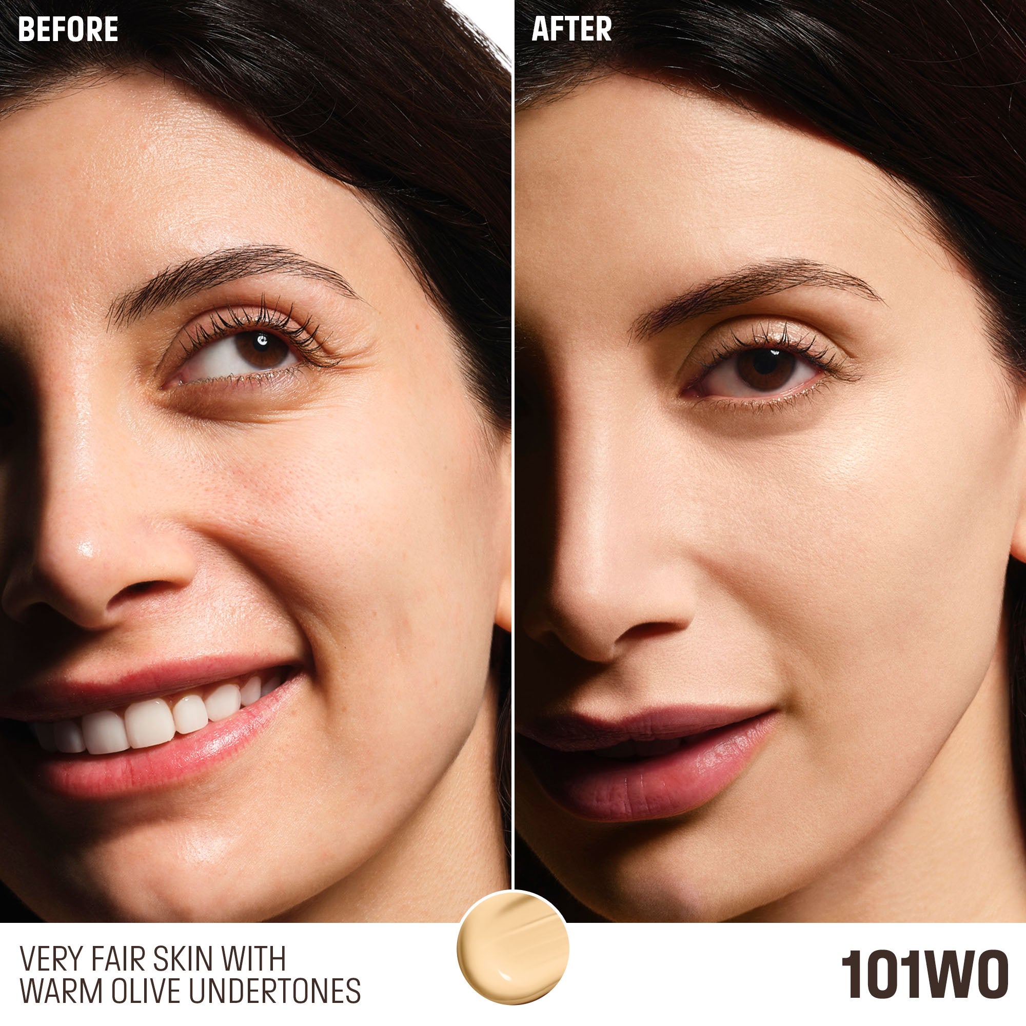 101WO LACE